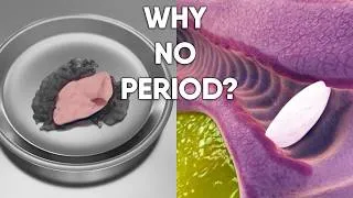Thumbnail: She Never Had a Period. Here's Why! | Original 3D Animation (Not AI-Generated)  #period #womanhealth