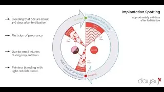 Thumbnail: Spotting vs Period - Ovulation Spotting, Implantation Spotting, Menstruation