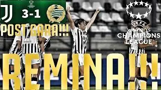Thumbnail: JUVENTUS - OGC Nizza 2-0 | HO APERTO IL CARRO DOUGLAS LUIZ!!! E CHE BRAVO OBOAVWODUO!!! | POST GARA