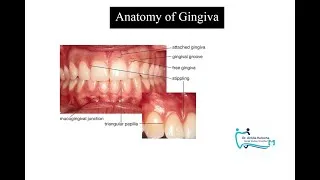 Thumbnail: ANATOMY OF GINGIVA|ORAL MUCOSA|PERIODONTAL TISSUE|TERMINOLOGIES|DR. ANKITA|DENTAL STUDIES SIMPLIFIED