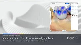 Thumbnail: DS Core - Plan Features: Restoration Thickness Analysis Tool