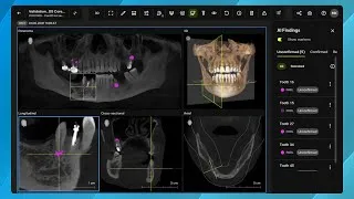 Thumbnail: DS Core - Diagnose Features: Smart View – Detect