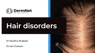 Thumbnail: Hair Disorders: Understanding Hair Growth, Loss, and Excess