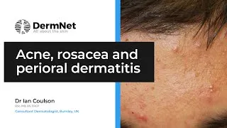 Thumbnail: Acne, Rosacea, and Perioral Dermatitis