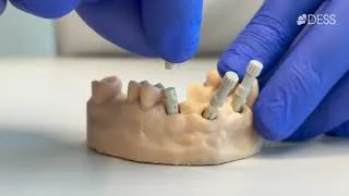 Thumbnail: DESS Scanbody Placement Tutorial for Intraoral Scanning