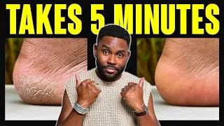 Thumbnail: How To Unf*ck Your FEET (in 5 minutes)