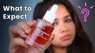 Thumbnail: 5 Things You NEED to Know About Anua Niacinamide 10% + TXA 4% Serum – What to Expect and How to Use?