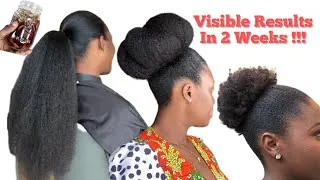Thumbnail: Chronic Hair Fall, Alopecia,  Breakage , Thinning, YOUR SOLUTION JUST DROPPED