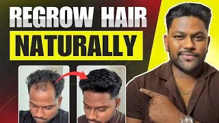 Thumbnail: How To Regrow Hair Naturally For Men | In Hindi | How To Get Thick Hair | Dipak Shaw