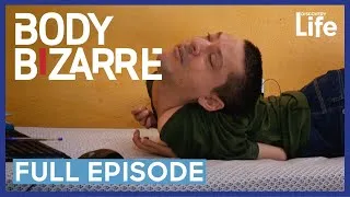 Thumbnail: Body Bizarre: The Incredible Upside Down Man | Full Episode