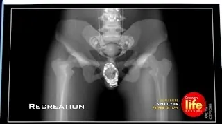 Thumbnail: Stolen Rolex Found On X-Ray