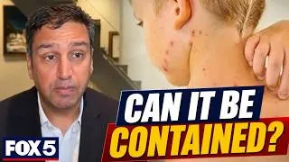 Thumbnail: Measles Cases Are Rising—What Happens When School Starts?