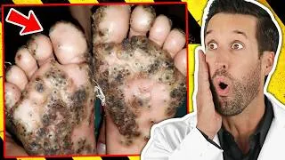 Thumbnail: ER Doctor REACTS to Deadliest Parasites Found Inside Humans #4