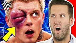 Thumbnail: ER Doctor REACTS to Brutal WWE Injuries #4