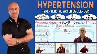 Thumbnail: Hypertension | Hypertensive Arteriosclerosis