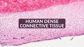 Thumbnail: Human Dense Connective Tissue