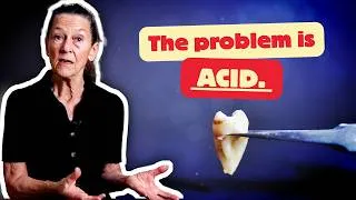Thumbnail: Don't Hurt Your Teeth When You Brush Them