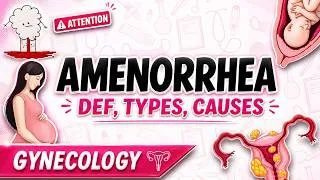 Thumbnail: A Doctor Explains SIMPLY What Amenorrhea Is and Its Main Causes | Gynecology