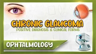 Thumbnail: 👁️ Chronic Glaucoma: Early Symptoms You Should Know, Diagnosis & Clinical Forms Explained