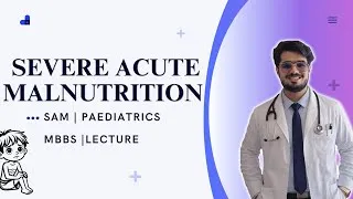 Thumbnail: Malnutrition - Severe Acute Malnutrition  SAM | NEET PG Pediatrics | MBBS LECTURE