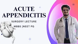 Thumbnail: Acute Appendicitis Surgery |  Lecture  for MBBS Students