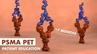 Thumbnail: PSMA PET scan for Prostate Cancer | Patient Education