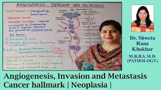 Thumbnail: Angiogenesis, Invasion and Metastasis | Cancer hallmark | Neoplasia |