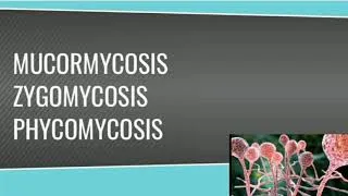 Thumbnail: Mucormycosis