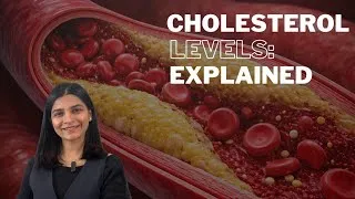 Thumbnail: Understand Your CHOLESTEROL PANEL | Good and Bad Cholesterol | Lipid Profile test