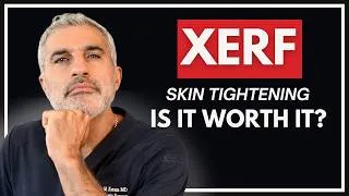 Thumbnail: Does XERF Skin Tightening Actually Work? A Facial Plastic Surgeon's Honest Review