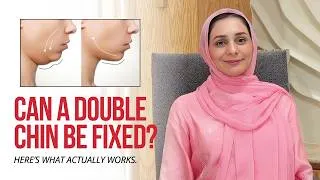 Thumbnail: Why You Have a Double Chin & How to Fix It | All Treatment Options | Dr. Amna