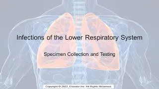 Thumbnail: Lower Respiratory Tract Specimen Collection and Testing