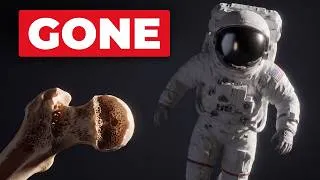 Thumbnail: NASA Found How To Stop Osteoporosis