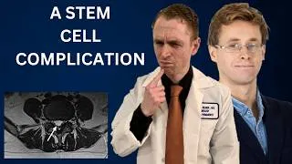Thumbnail: Stem Cell Complication (Arachnoiditis in Multiple Sclerosis Trial)