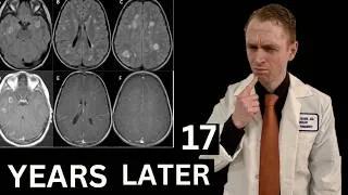 Thumbnail: How is This 13-Year-Old Girl Doing 17 Years Later?  (Multiple Sclerosis)