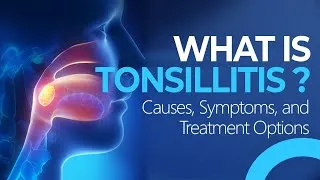 Thumbnail: Tonsillitis Explained: Causes, Symptoms & Treatment | Viral vs. Bacterial