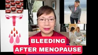 Thumbnail: PAGDURUGO PAGKATAPOS NG MENOPAUSE  ( POSTMENOPAUSAL BLEEDING) vlog 269
