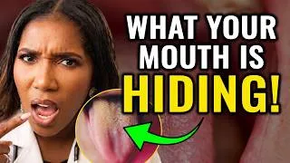 Thumbnail: Kidney Disease Warning Signs In Your Mouth! Nephrologist Dr. Frita Explains Symptoms To Watch For