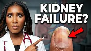 Thumbnail: Kidney Disease Warning Signs Your Nails Are Telling You - No. 4 Is Sneaky!