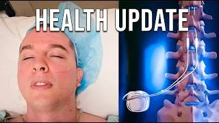 Thumbnail: Recovering From Spinal Cord Stimulator Implant Surgery (Health Update)