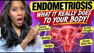 Thumbnail: What Endometriosis Actually Does to Your Body! A Doctor Reveals What You Should Know