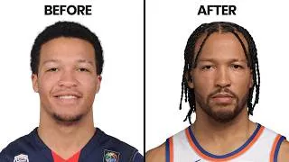 Thumbnail: Is Jalen Brunson Losing His Hair? | Hair Surgeon Reacts