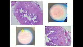 Thumbnail: Histology slide identification: Ureter - By Dr Mitesh Dave