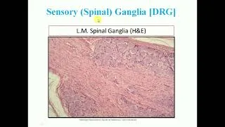 Thumbnail: Histology slide identification: Ganglia - By Dr Mitesh Dave