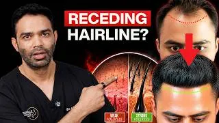 Thumbnail: Is Your Hairline Receding? Follow This 5-Step Hair Rescue Plan Before It's Too Late