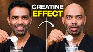 Thumbnail: Is Creatine REALLY Causing Hair Loss?