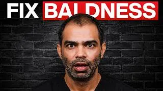 Thumbnail: The SHOCKING Truth About Male Pattern Baldness Nobody Tells You