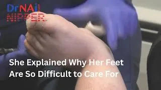 Thumbnail: She Explained Why Her Feet Are So Difficult to Care For