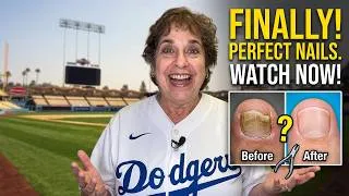Thumbnail: FEET-ure Friday | This Toenail Curled Completely Around the Toe! 😳 | Shelter Foot Care