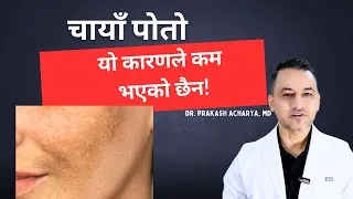 Thumbnail: Why is your Melasma not improving? Dr. Prakash Acharya
